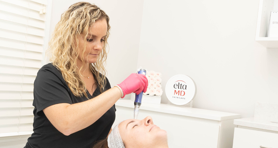 Microneedling at Azura Skin Care Center