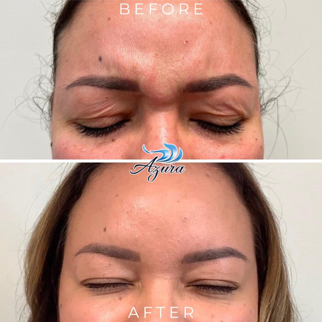 Before and After Landscape Template Letybo