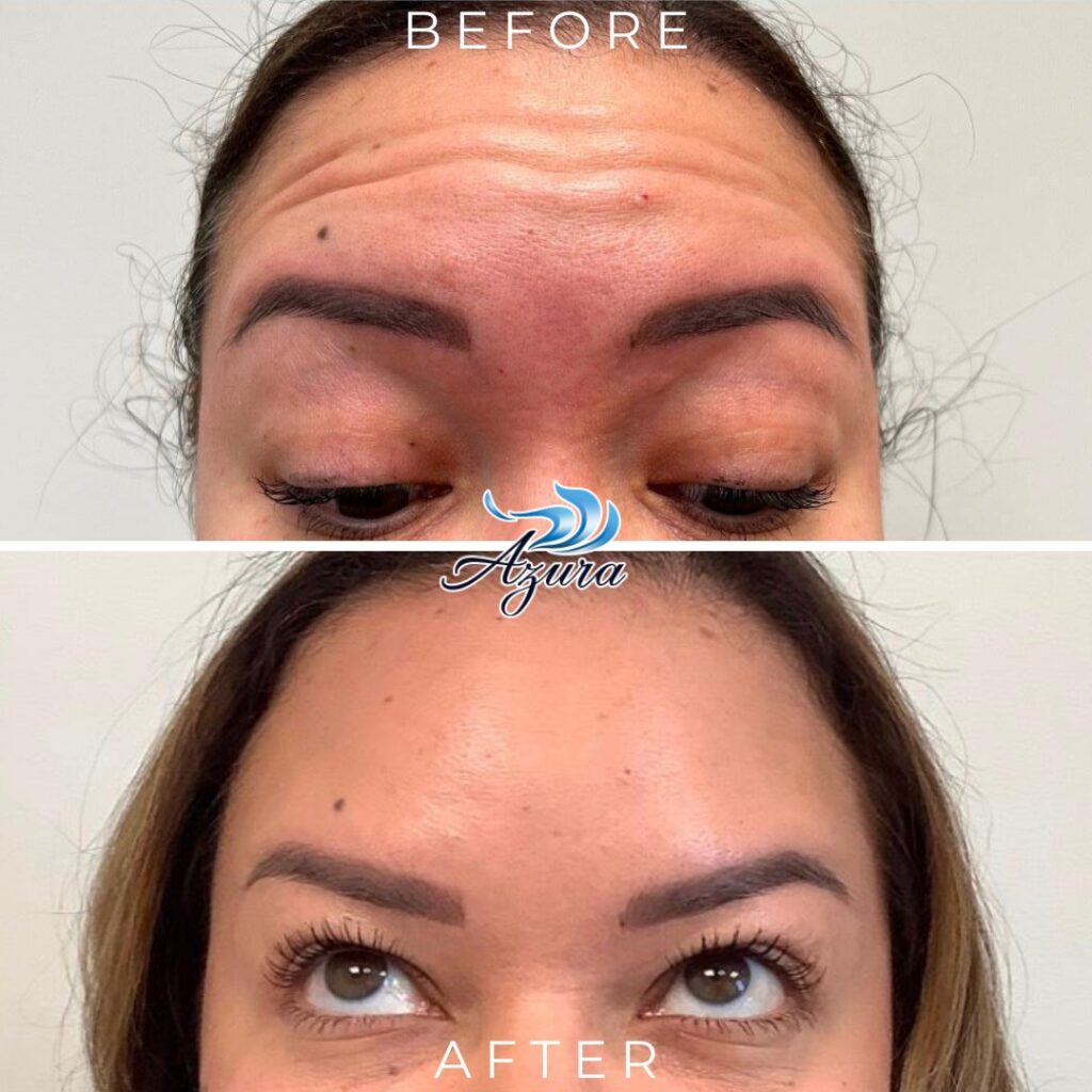 Before and After Landscape Template Letybo at Azura