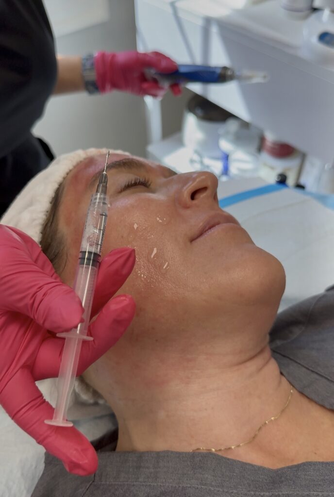 PDGF at Azura Skin Care Center