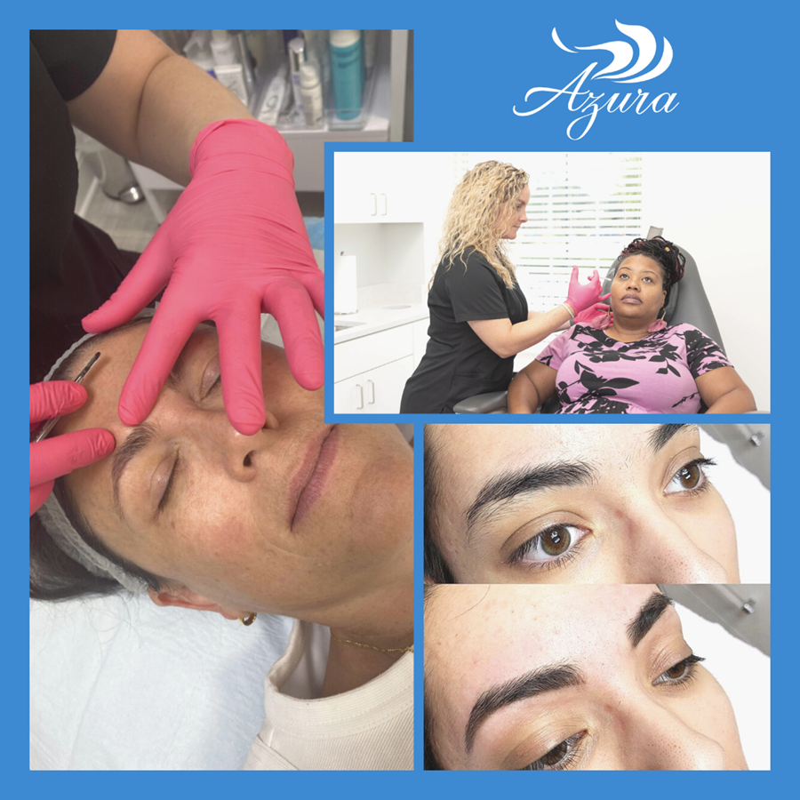 Injectables, Dermaplaning, and Brows at Azura Skin Care Center