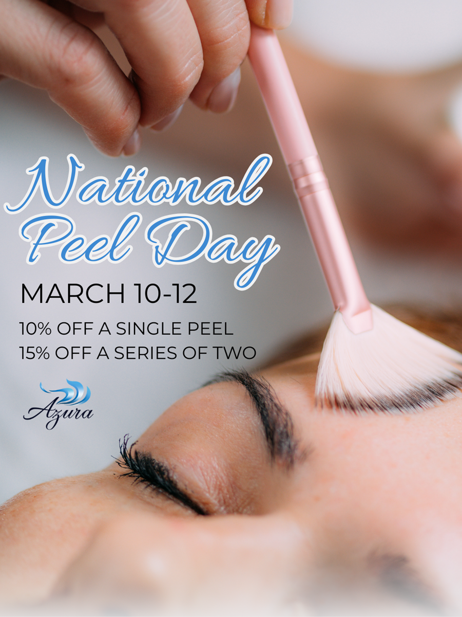 National Peel Day at Azura