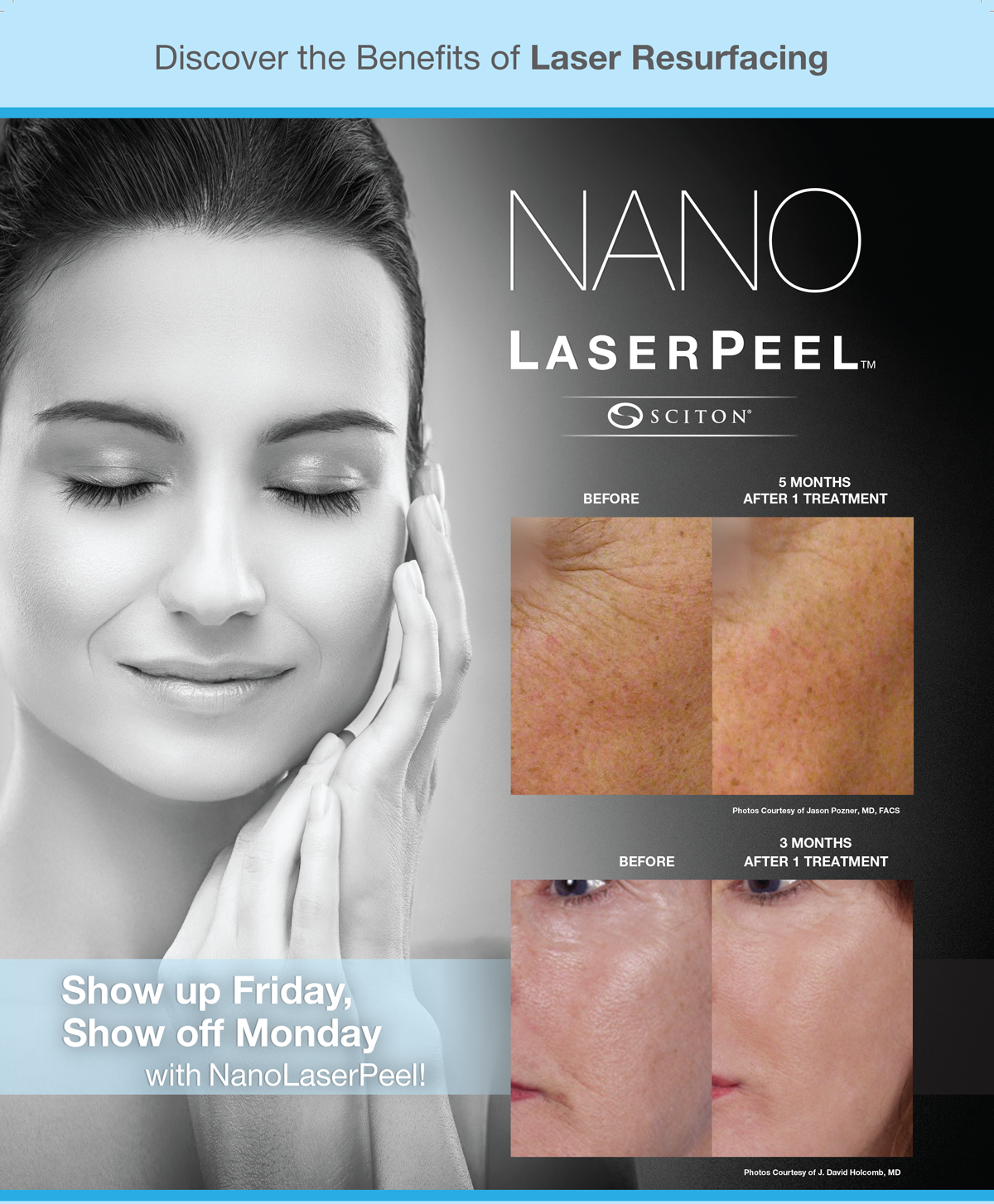 NanoLaserPeel Cary NC Azura Skin Care Center