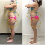 Physiq Before and After - Azura Skin Care Center Cary NC