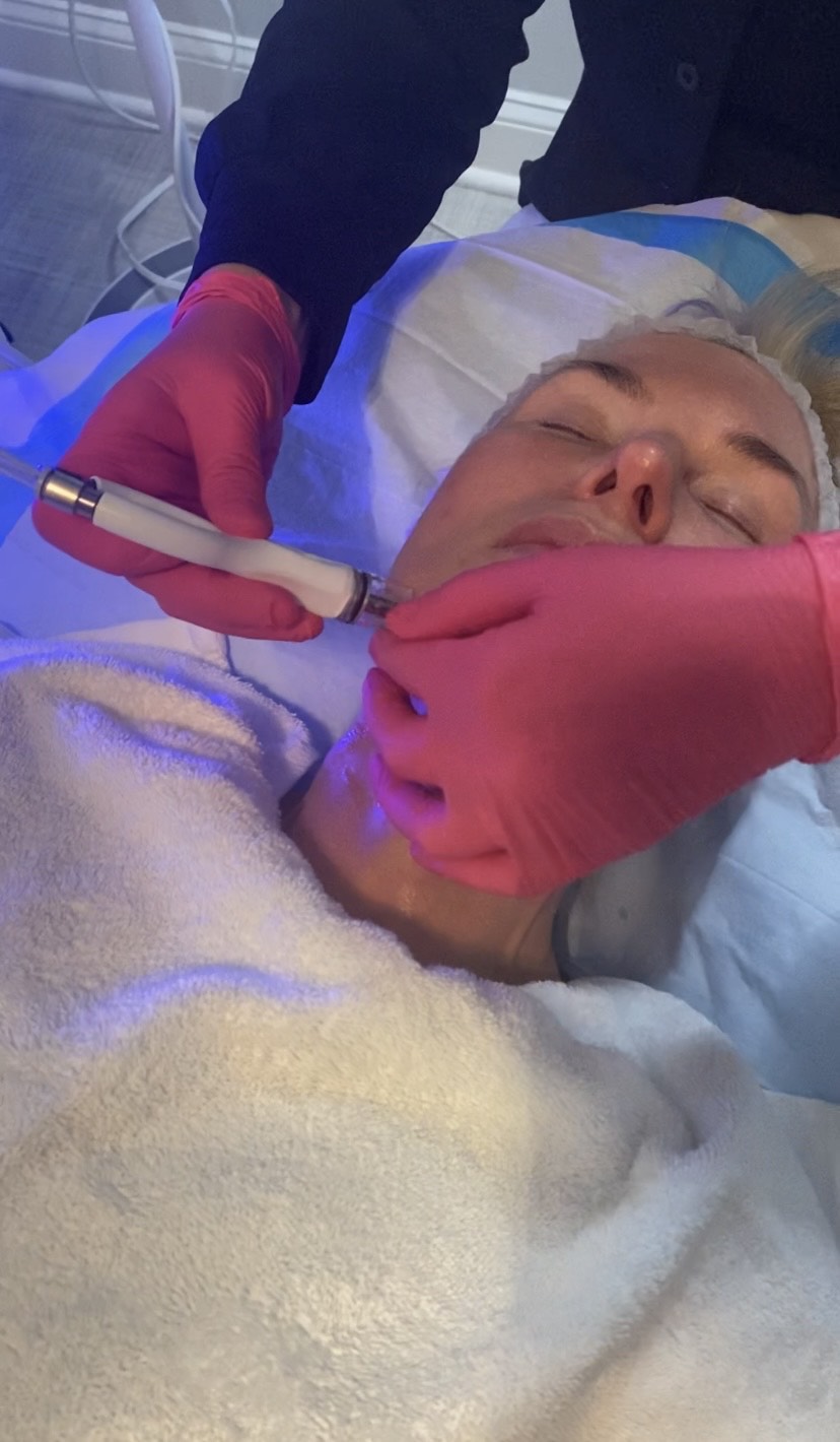 Diamond Glow Facial at Azura Skin Care Center Cary NC