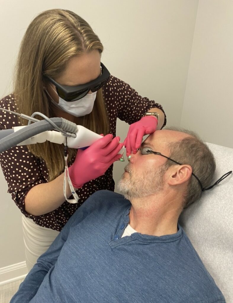 Laser Treatment for Blood Vessels on Face at Azura Skin Care Center Cary NC
