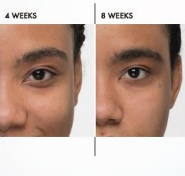 Obagi Nucil Brow Serum Before and After Azura Skin Care Center